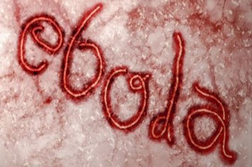 Profissionais da Saúde de Paraguaçu participam de palestra sobre Ebola, Chikungunya e Dengue