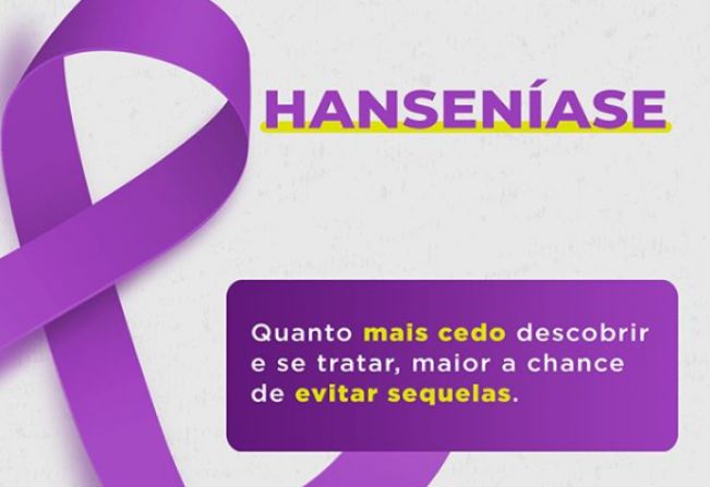 Janeiro Roxo é o mês da conscientização sobre a hanseníase