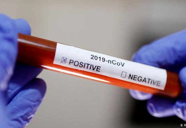 Testes rápidos vêm da China e se destinam a profissionais da saúde, segundo Ministério da Saúde